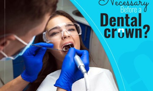 Is a Root Canal Necessary Before a Dental Crown?